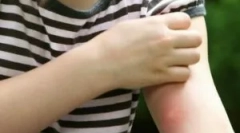 Zašto izgristi se i šta da radim?